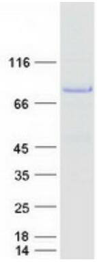 Coomassie blue staining of purified NUMB protein.